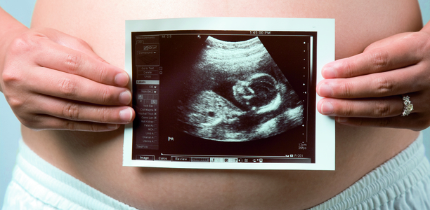 Bild zu 20. Schwangerschaftswoche - DEGUM fordert Ultraschall als Regelleistung