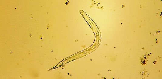 Bild zu Parasitosen - Wenn Würmer krank machen - Helminthosen in der Pädiatrie