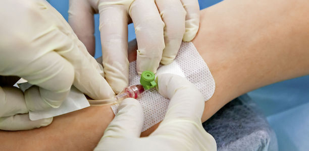 Bild zu  Blutentnahme - Schmerzempfinden bei der Kanülierung von Venen