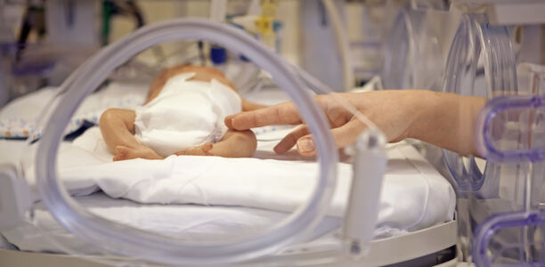 Bild zu Frühgeborene - Einfluss der Aufnahmetemperatur auf Mortalität und Morbidität 