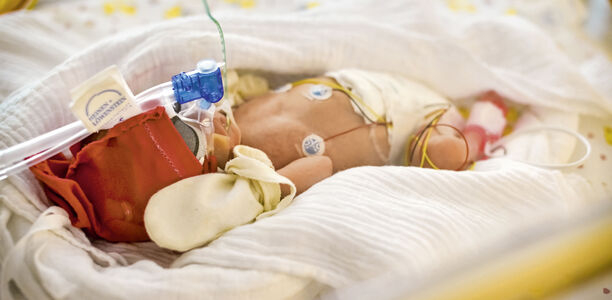 Bild zu Frühgeborene - Inflammation als Risikofaktor für eine bronchopulmonale Dysplasie?
