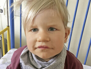 Bild zu Der diagnostische Blick - Ein 20 Monate altes Mädchen mit Dysmorphie-Retardierungs-Syndrom