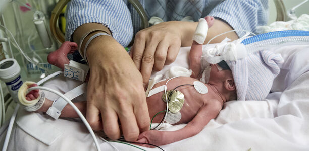 Bild zu Frühgeborene - Hydrocortison zur Verbesserung des Überlebens ohne bronchopulmonale Dysplasie 