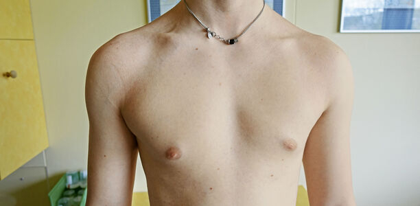 Bild zu Der diagnostische Blick - Ein 17-jähriger Junge mit Abflachung der linken vorderen Thoraxmuskulatur