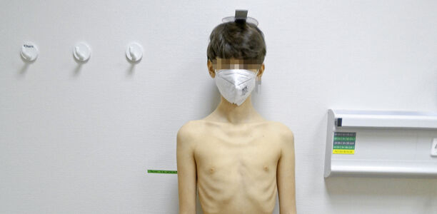 Bild zu Der diagnotische Blick - Ein 15-jähriger Junge mit Untergewicht und Ikterus