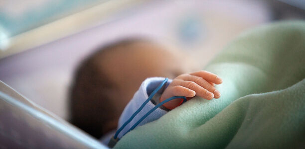 Bild zu Studie - Zerebrales Oxymetrie-Monitoring bei extrem frühgeborenen Kindern?